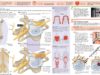 infografico-max-hernia-discal (1)